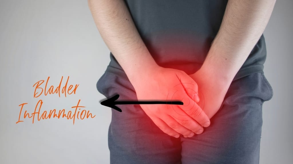 Bladder Inflammation