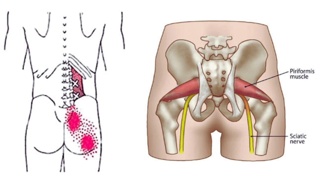 Sciatic nerve