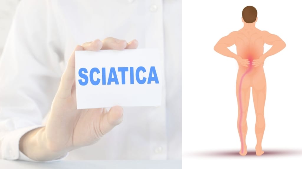 Sciatica Symptoms