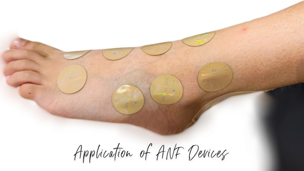 Application of ANF Devices