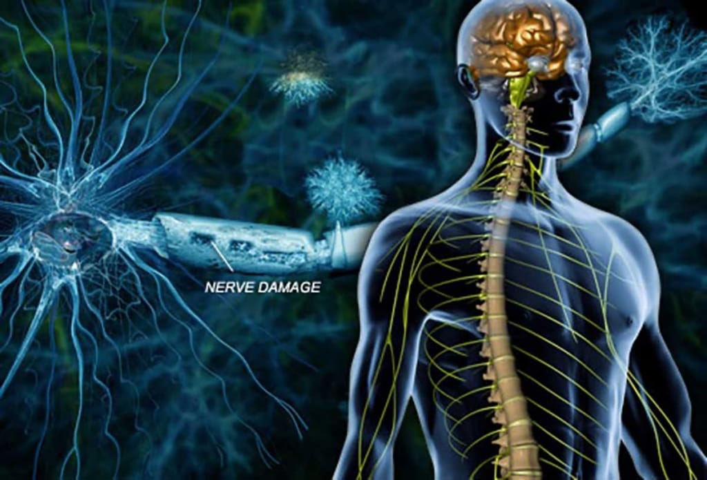 Nerve Damage