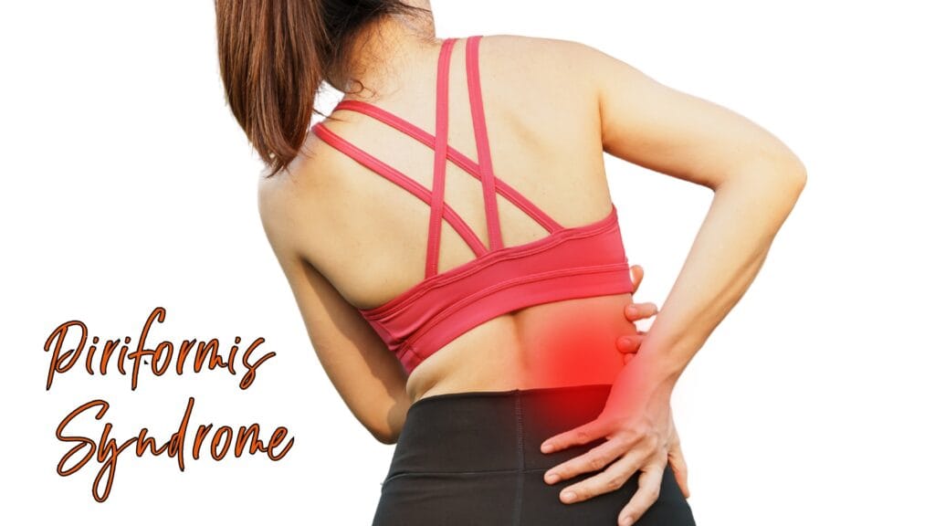 Piriformis Syndrome Symptoms Causes Management