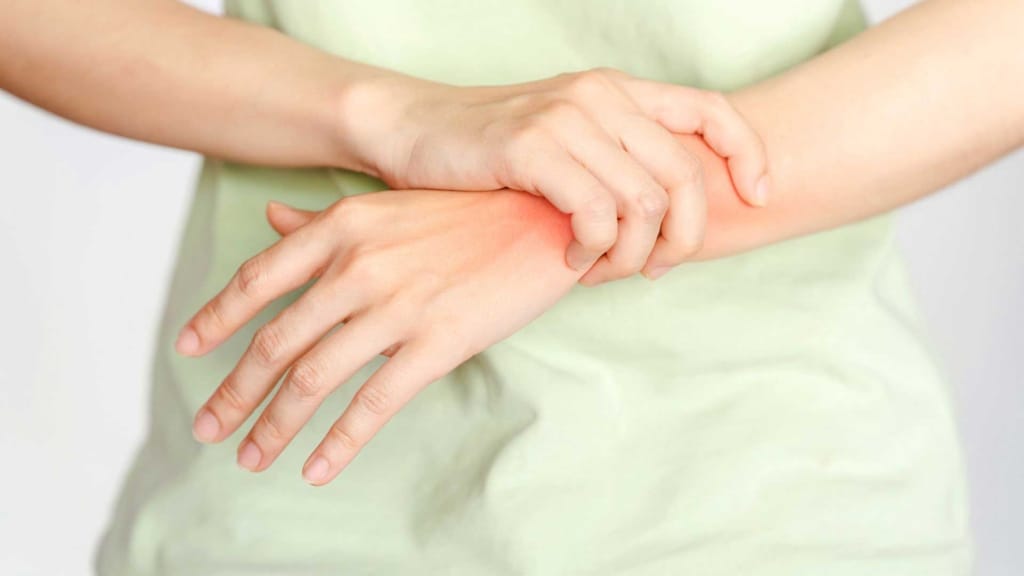 Rheumatoid Arthritis Symptoms