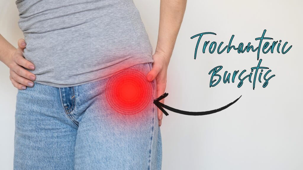 Trochanteric bursitis