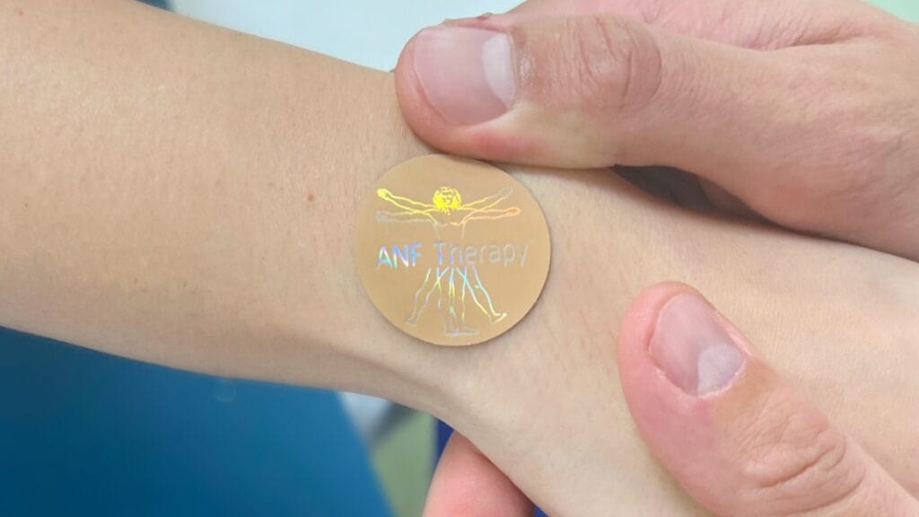 anf device on wrist